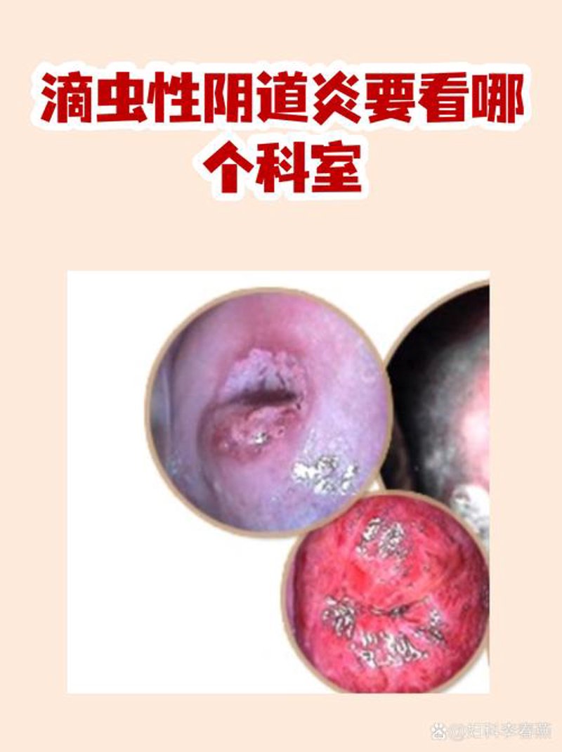 妇科